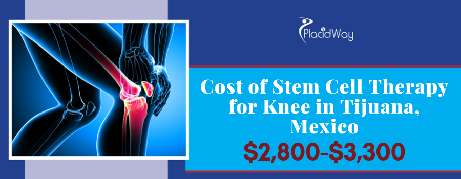 Best Knee Stem Cell Package in Tijuana, Mexico